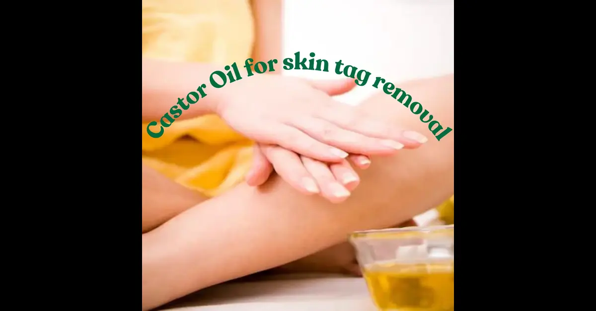 Castor oil for Skin Tag